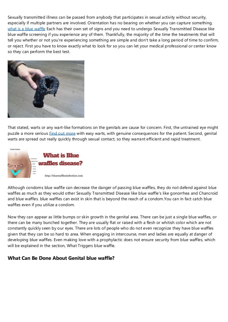 Brazilian Wax Pictures Before and After Brazilian Wax Pictures Before and After
